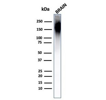 Neurofilament Antibody / Heavy