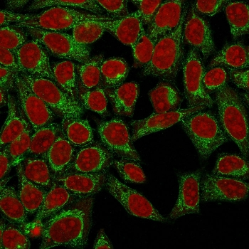 Podocalyxin Antibody