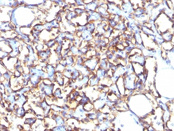 Podocalyxin Antibody