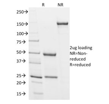 Podocalyxin Antibody