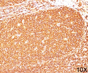 CD45RB Antibody (B-cell marker)