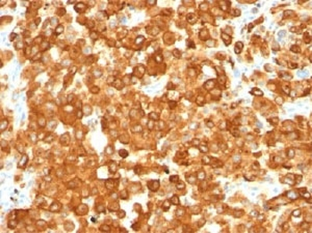 gp100 Antibody