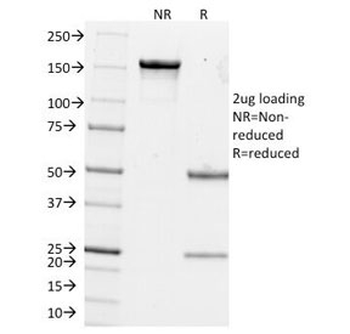 Estrogen Inducible Protein pS2 / TFF1 Antibody