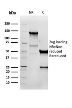 Recombinant Vimentin Antibody
