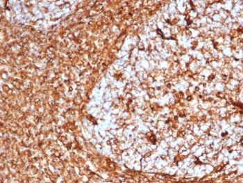 Recombinant Vimentin Antibody