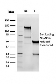Recombinant Vimentin Antibody
