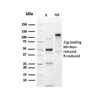 Recombinant Prostein Antibody / SLC45A3