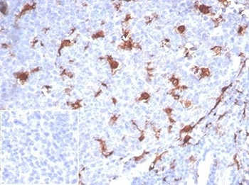 LPLUNC1 Antibody / BPIFB1