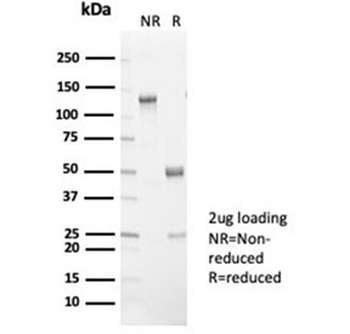 LPLUNC1 Antibody / BPIFB1