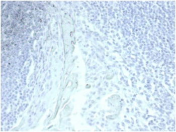 Recombinant Gastric Mucin Antibody / MUC5AC