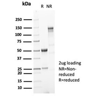Recombinant Gastric Mucin Antibody / MUC5AC