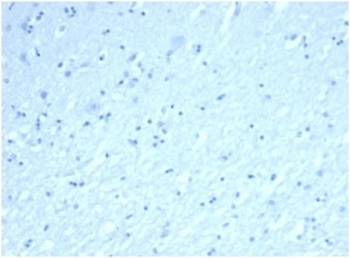 Recombinant INHA Antibody / Inhibin alpha