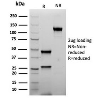 Recombinant INHA Antibody / Inhibin alpha