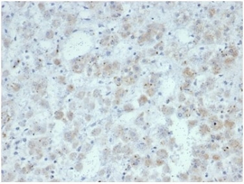 Recombinant IL15 Antibody / Interleukin 15