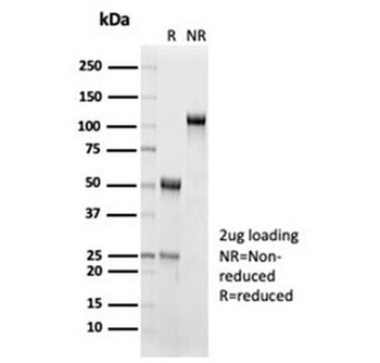 Recombinant IL15 Antibody / Interleukin 15