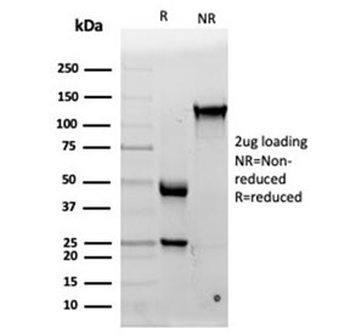 Interleukin 15 Antibody / IL15