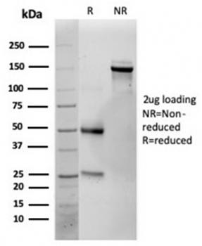 IL-25 Antibody / IL-17E