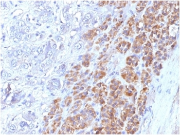 IL-25 Antibody / IL-17E