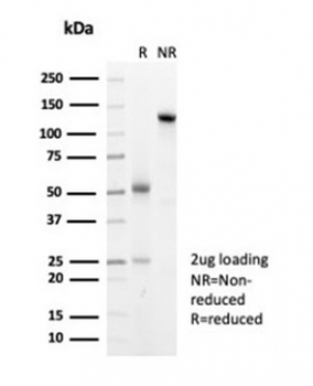 Recombinant HSP27 Antibody / HSPB1