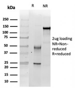 INI1 Antibody / Integrase interactor 1 / SMARCB1 / BAF47