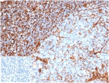 Recombinant VIM Antibody / Vimentin