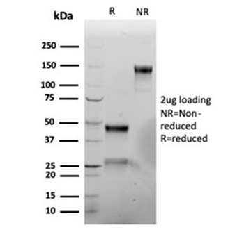 Recombinant VIM Antibody / Vimentin