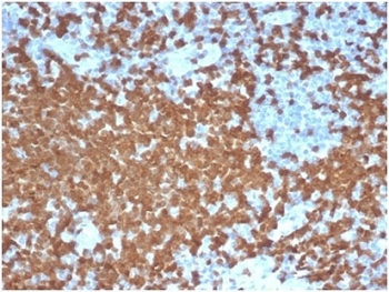 Recombinant ZAP70 Antibody