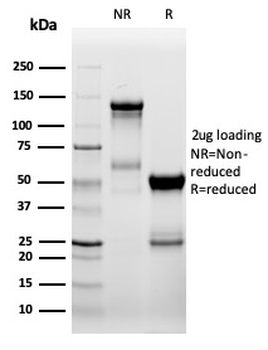 Recombinant ZAP70 Antibody
