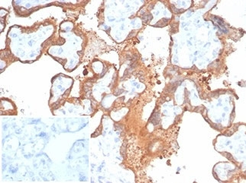 Recombinant Transglutaminase 2 Antibody (FN Binding Domain)