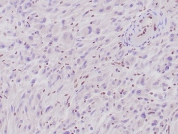 SMARCB1 Antibody / Integrase interactor 1 / INI1 / BAF47