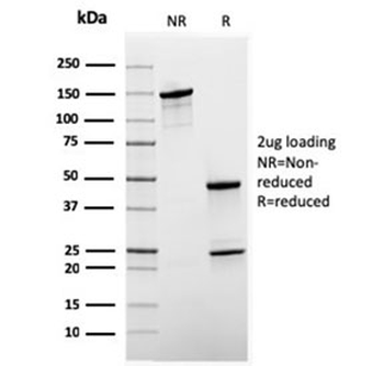 Recombinant SHBG Antibody / Sex Hormone Binding Globulin