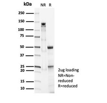 SFTPD Antibody / Surfactant protein D