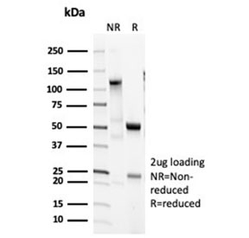 Recombinant Surfactant protein D Antibody / SFTPD