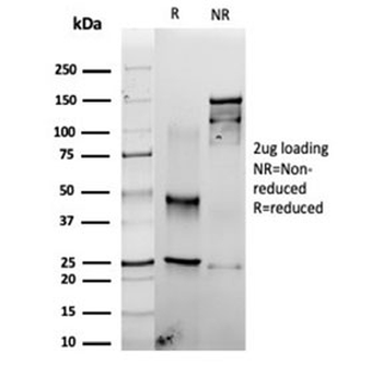 Recombinant FSCN1 Antibody / Fascin 1