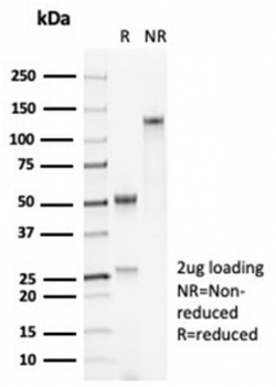 Recombinant Surfactant protein D Antibody / SFTPD