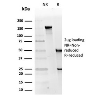 RPA32 Antibody / RPA2 / Replication Protein A2