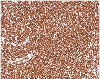 RPA32 Antibody / RPA2 / Replication Protein A2