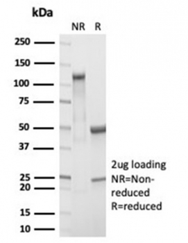 Recombinant Retinol Binding Protein 4 Antibody / RBP4
