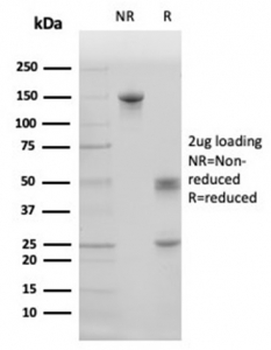 Surfactant protein D Antibody / SFTPD