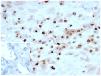 Recombinant p57Kip2 Antibody / p57
