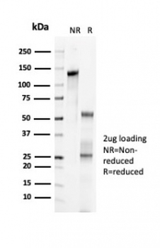 Recombinant p57Kip2 Antibody / p57