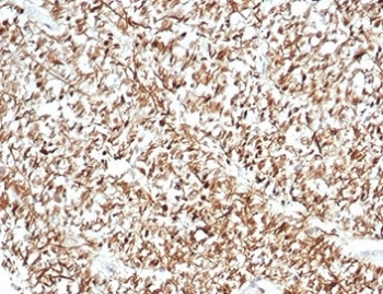 Calbindin 2 Antibody / CALB2 / Calretinin
