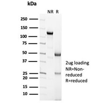 Calbindin 2 Antibody / CALB2 / Calretinin