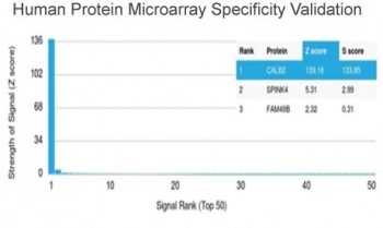 Calbindin 2 Antibody / CALB2 / Calretinin