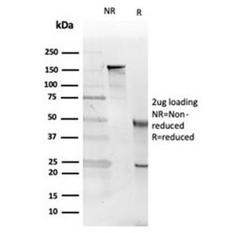 Interleukin 5 Antibody / IL5