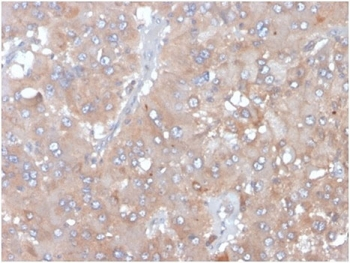 Interleukin 5 Antibody / IL5