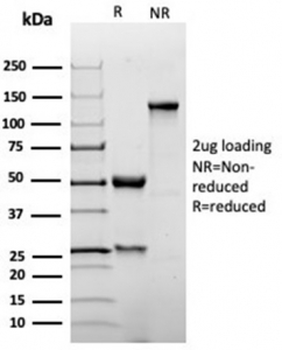 Recombinant p27Kip1 Antibody / p27 / CDKN1B