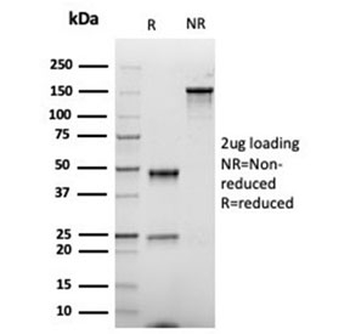Recombinant CD86 Antibody