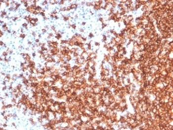 Recombinant CD20 Antibody