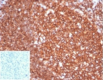 Recombinant CD20 Antibody